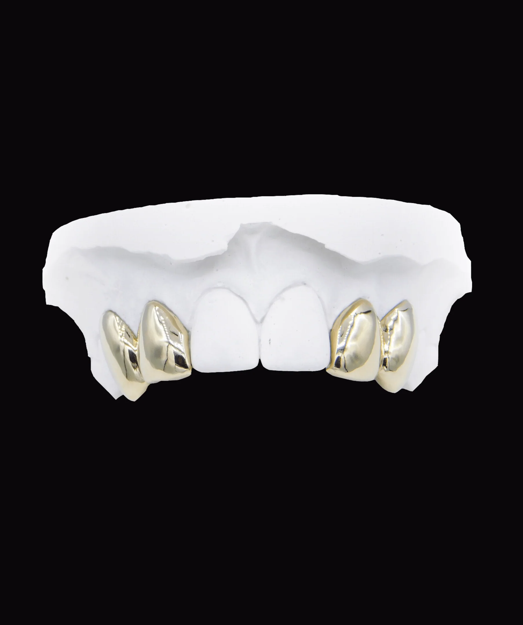 Four Gold Teeth