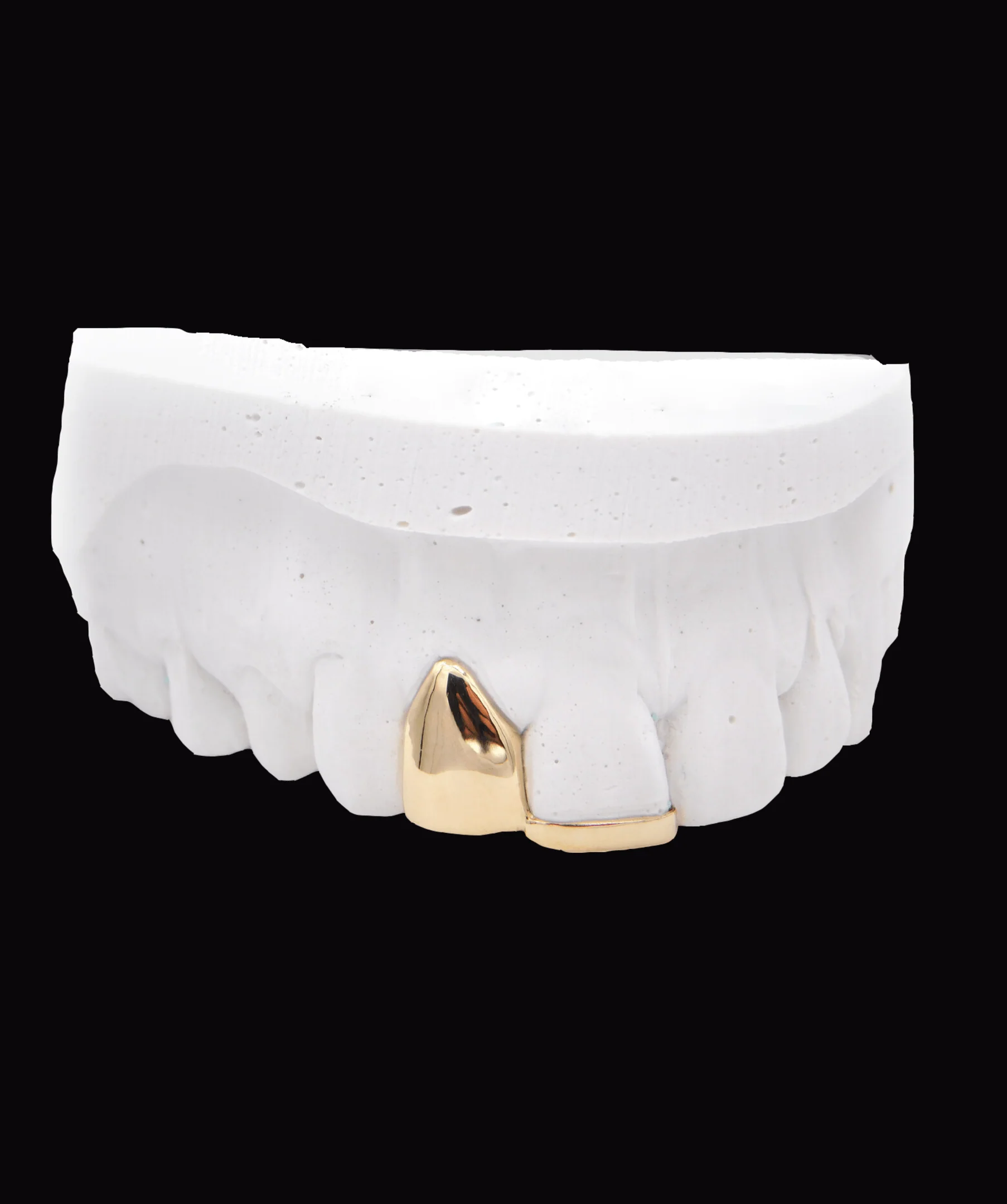 Gold Tooth & Gold Strip