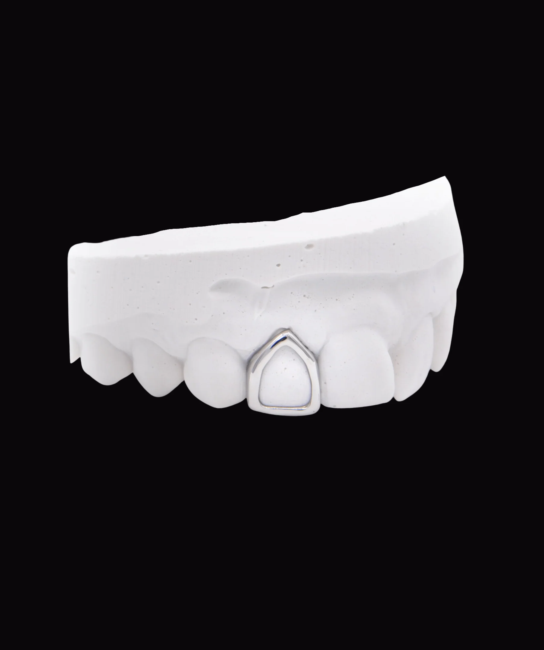 Gold Window Tooth - Image 2