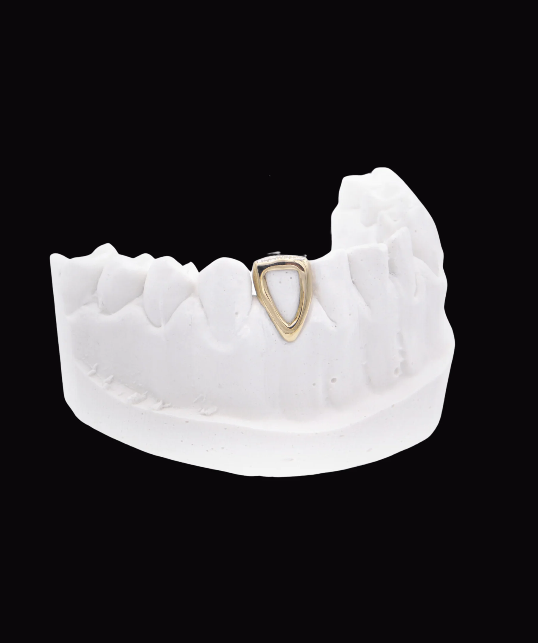 Gold Window Tooth - Image 3