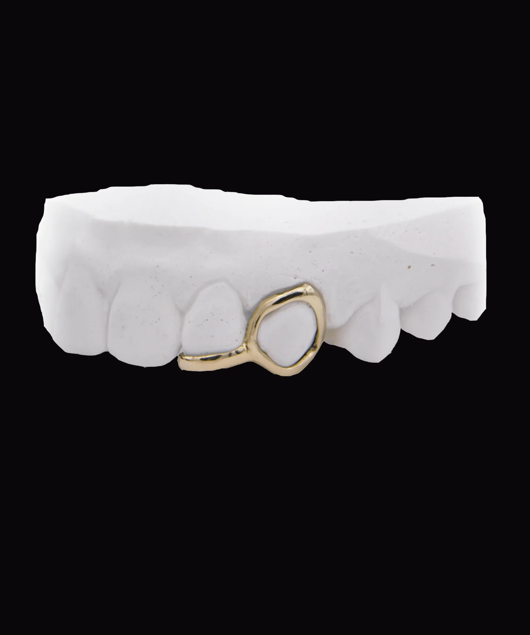 Gold Window Tooth & Gold Strip