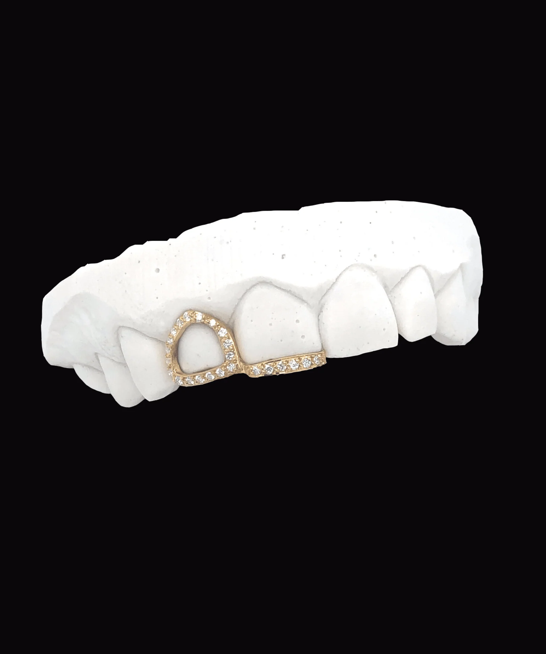Iced Window Tooth & Strip
