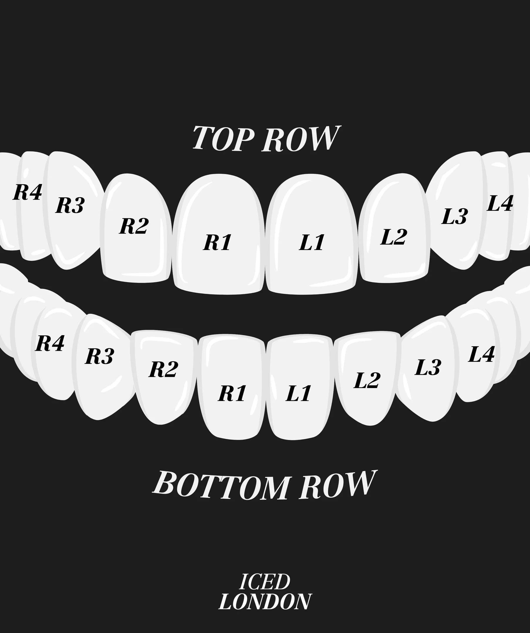 Lower Gold Grillz - Image 3
