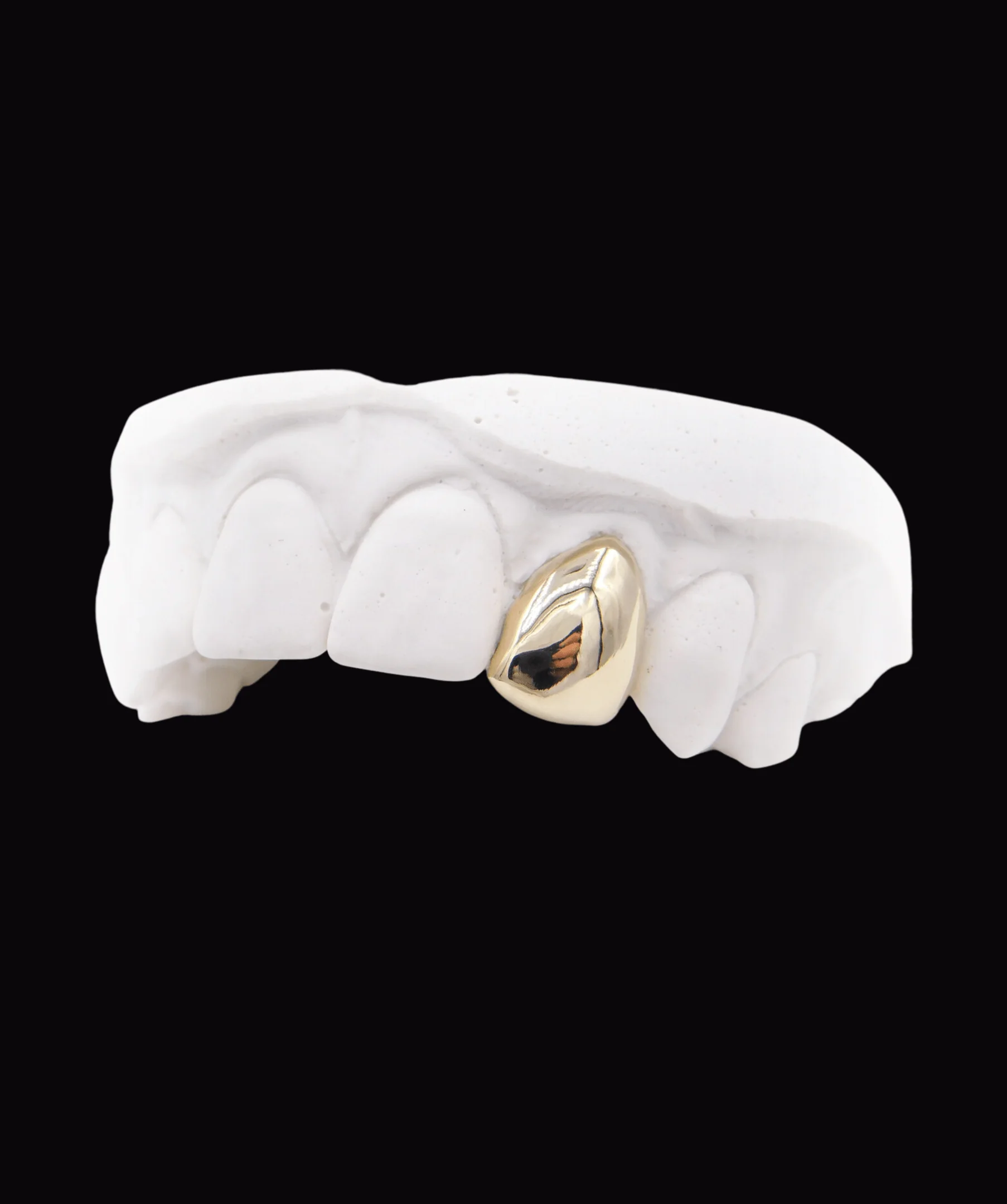 Single Gold Tooth