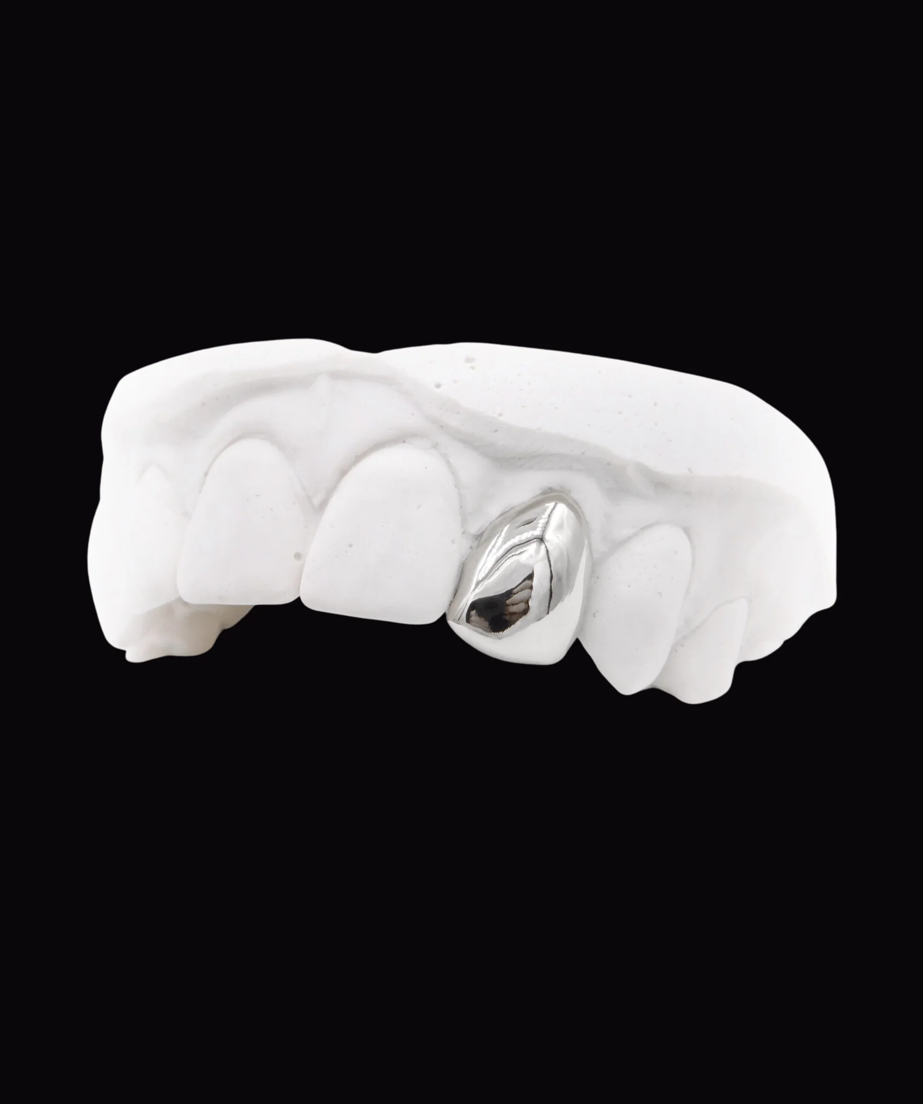 Single Gold Tooth - Image 2