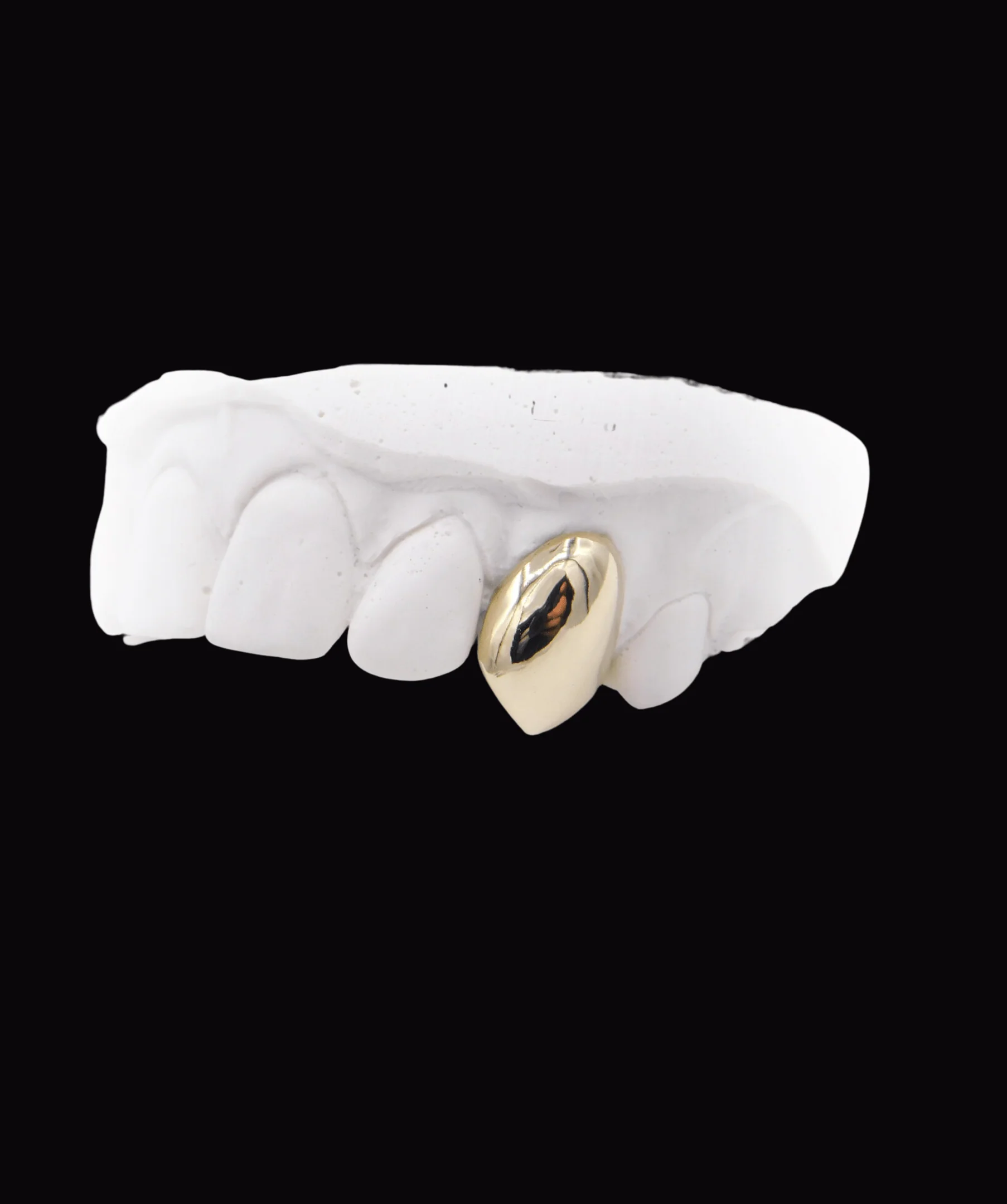 Single Gold Tooth - Image 3