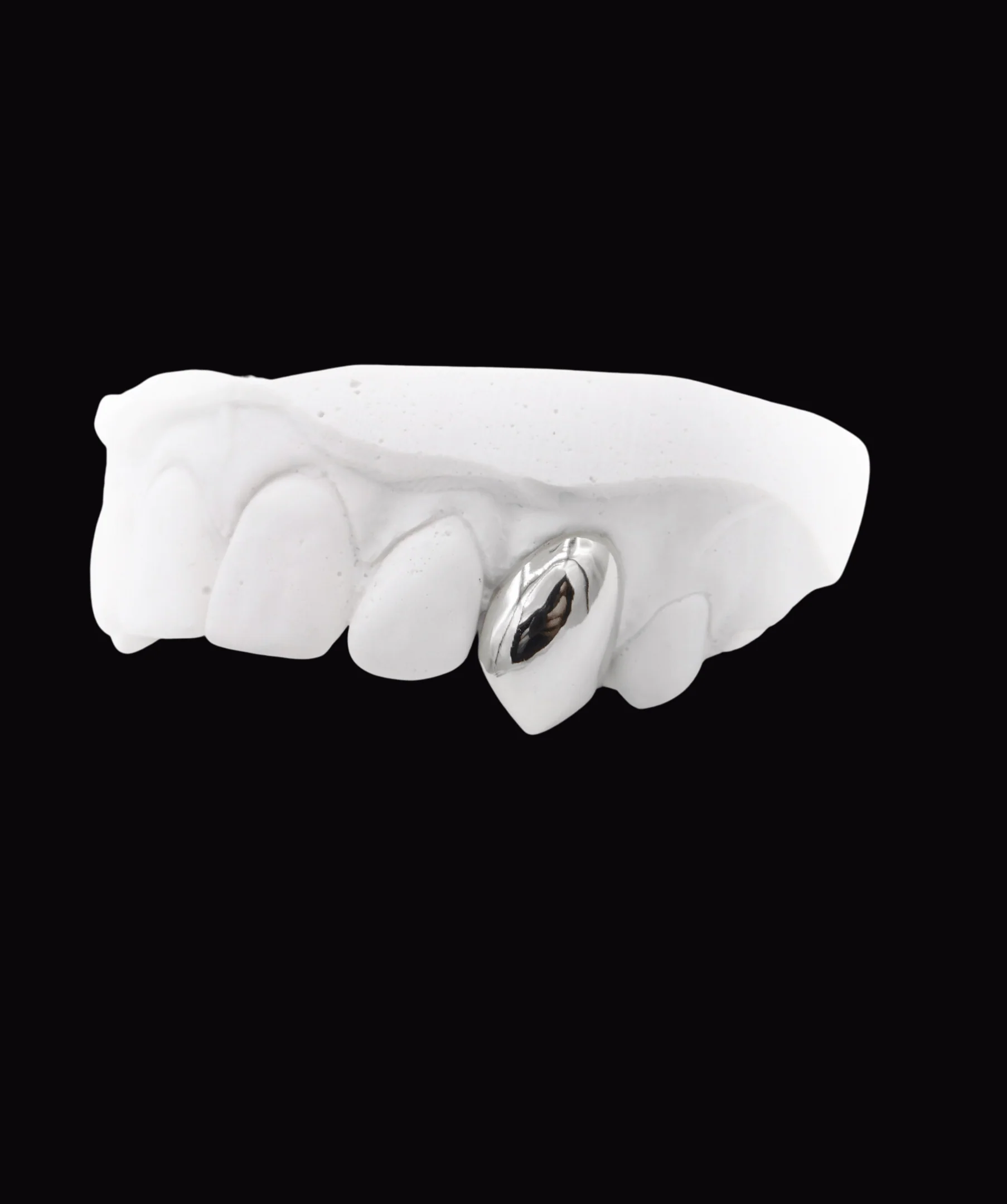 Single Gold Tooth - Image 4