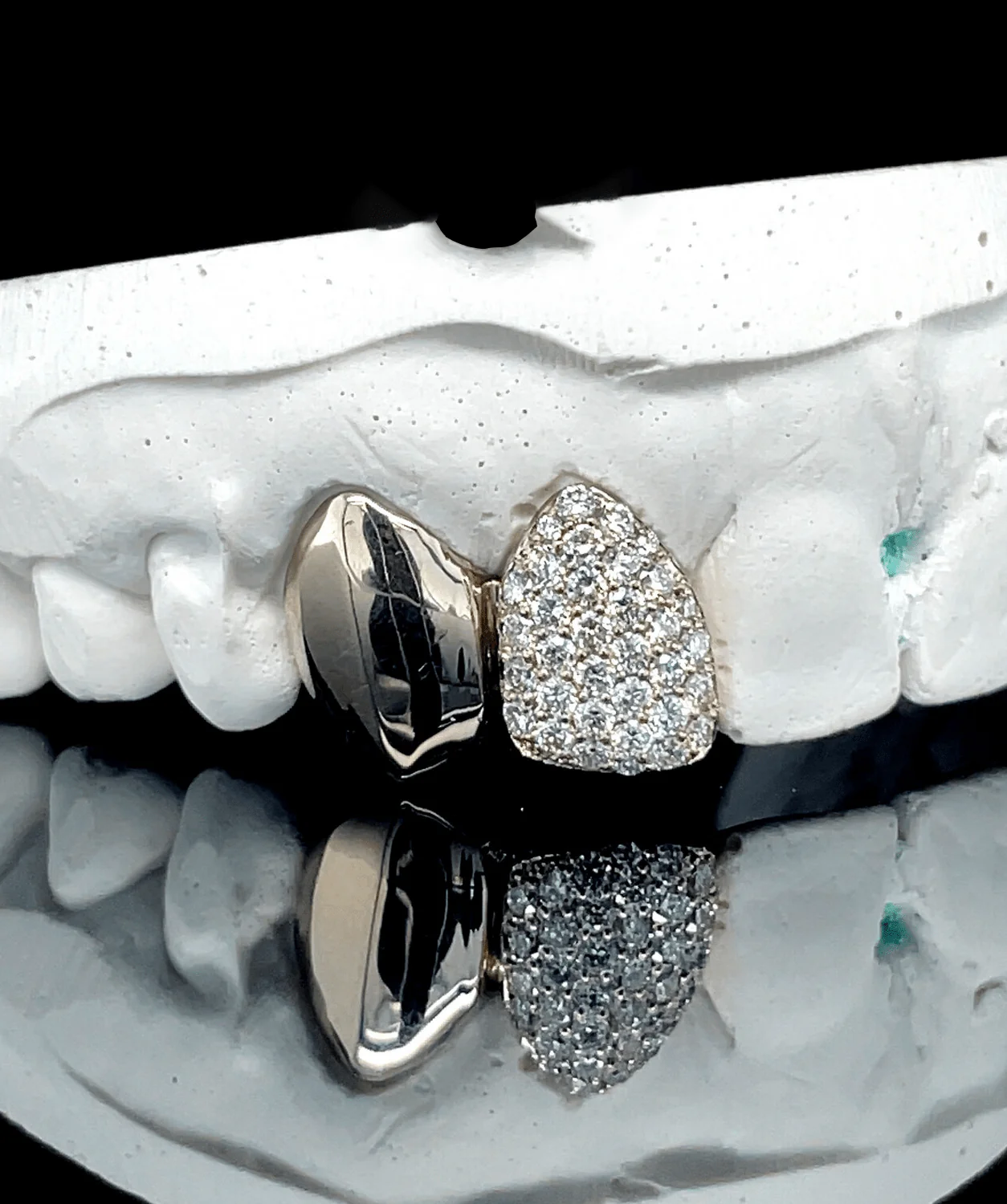 Single Iced & Plain Gold tooth - Image 2
