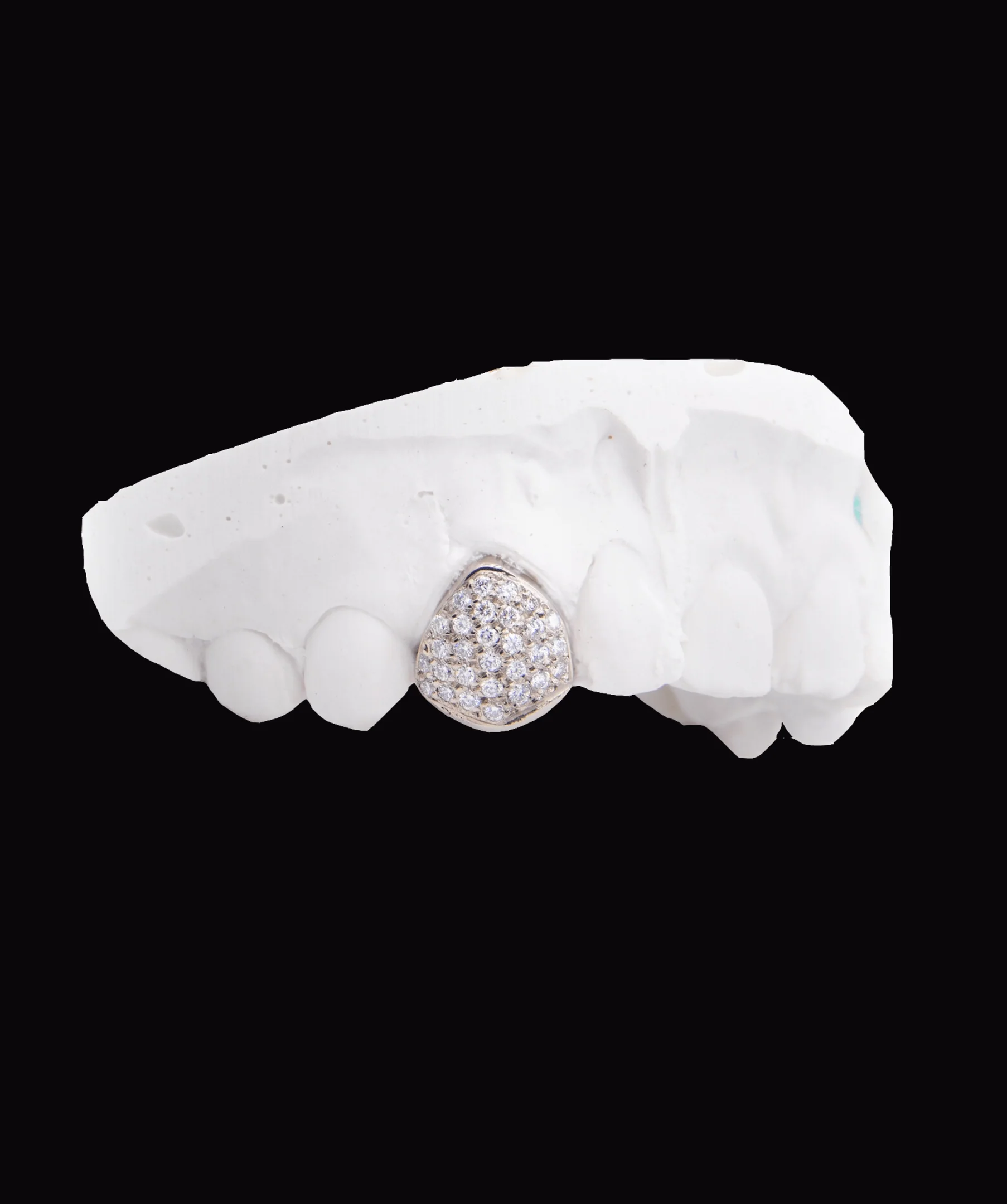 Single Iced Tooth