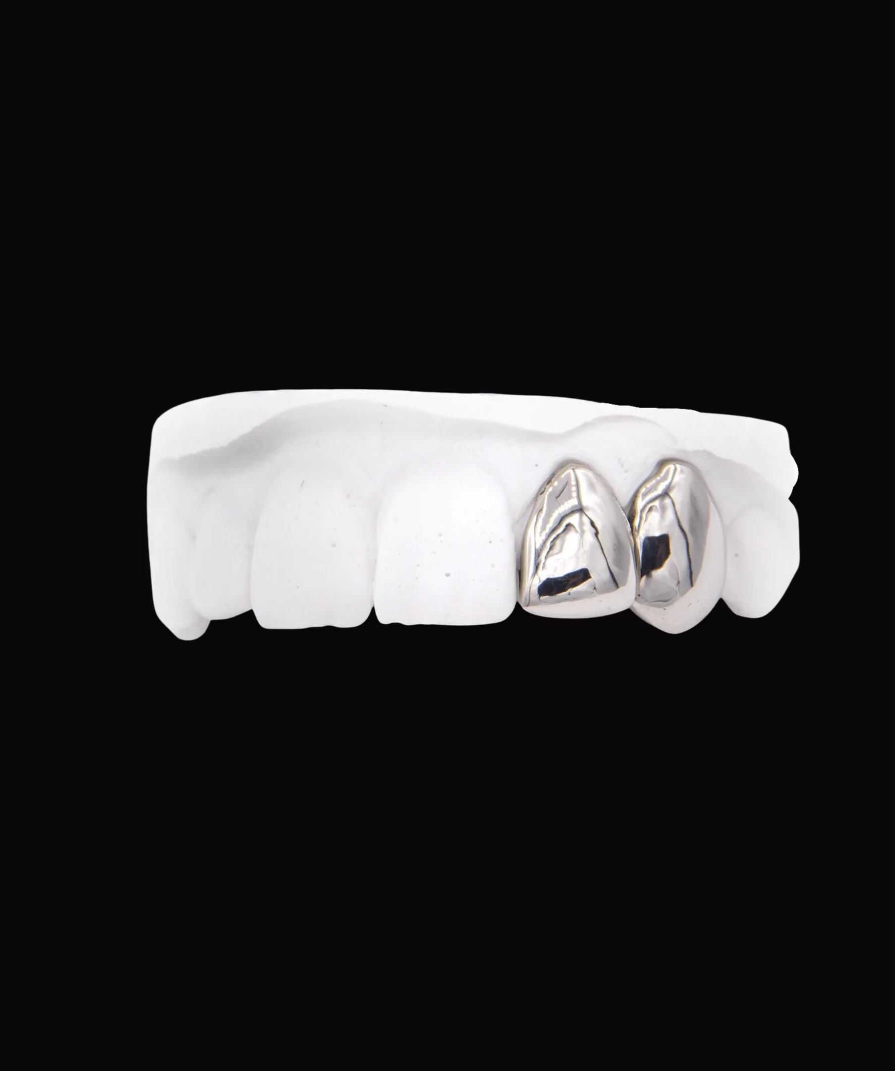 Two Gold Teeth - Image 2