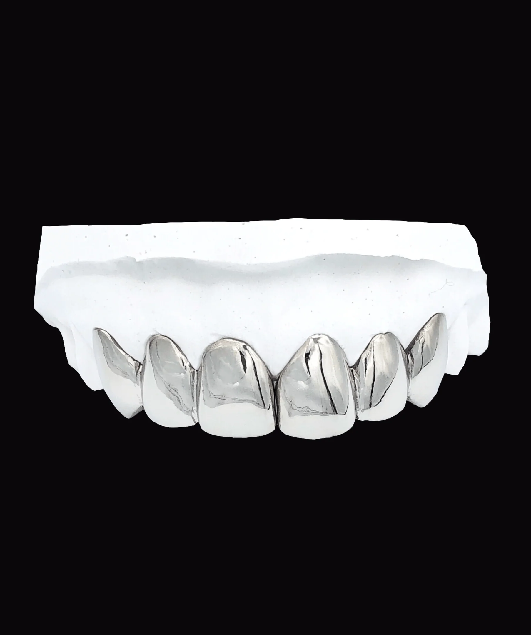 Upper Gold Grillz