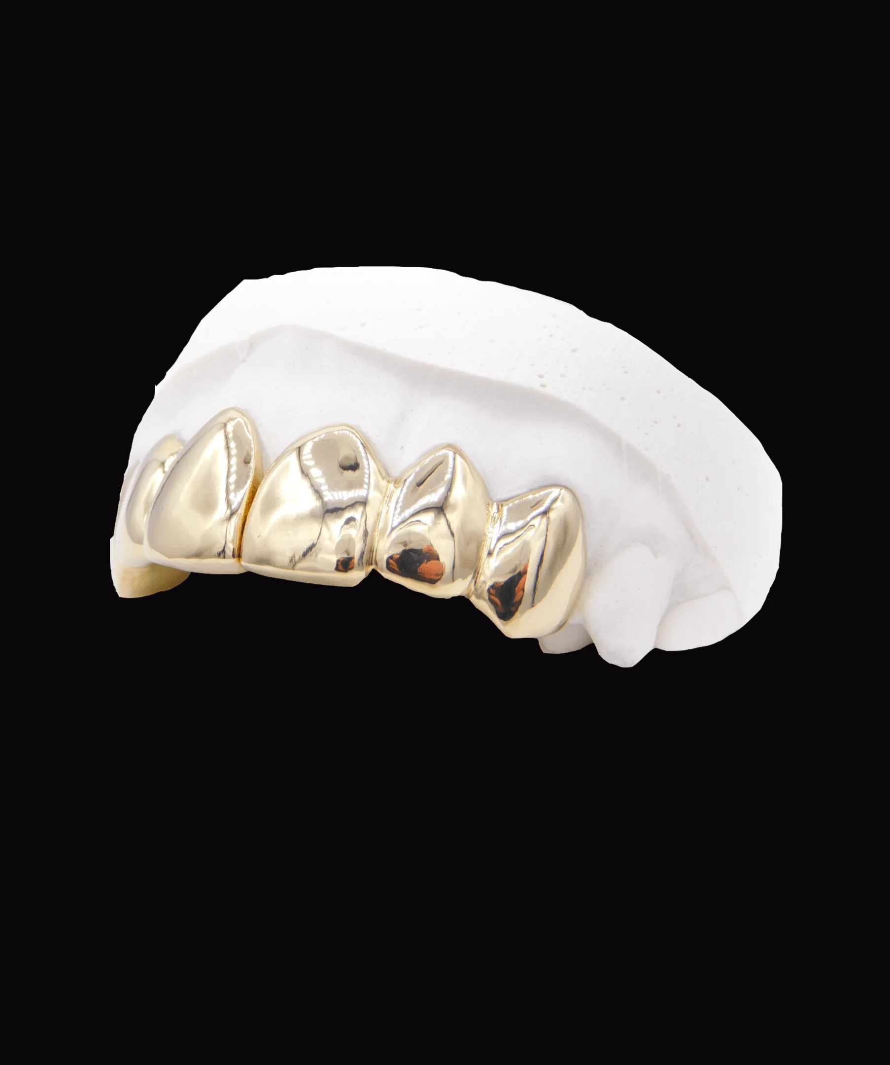 Upper Gold Grillz - Image 2