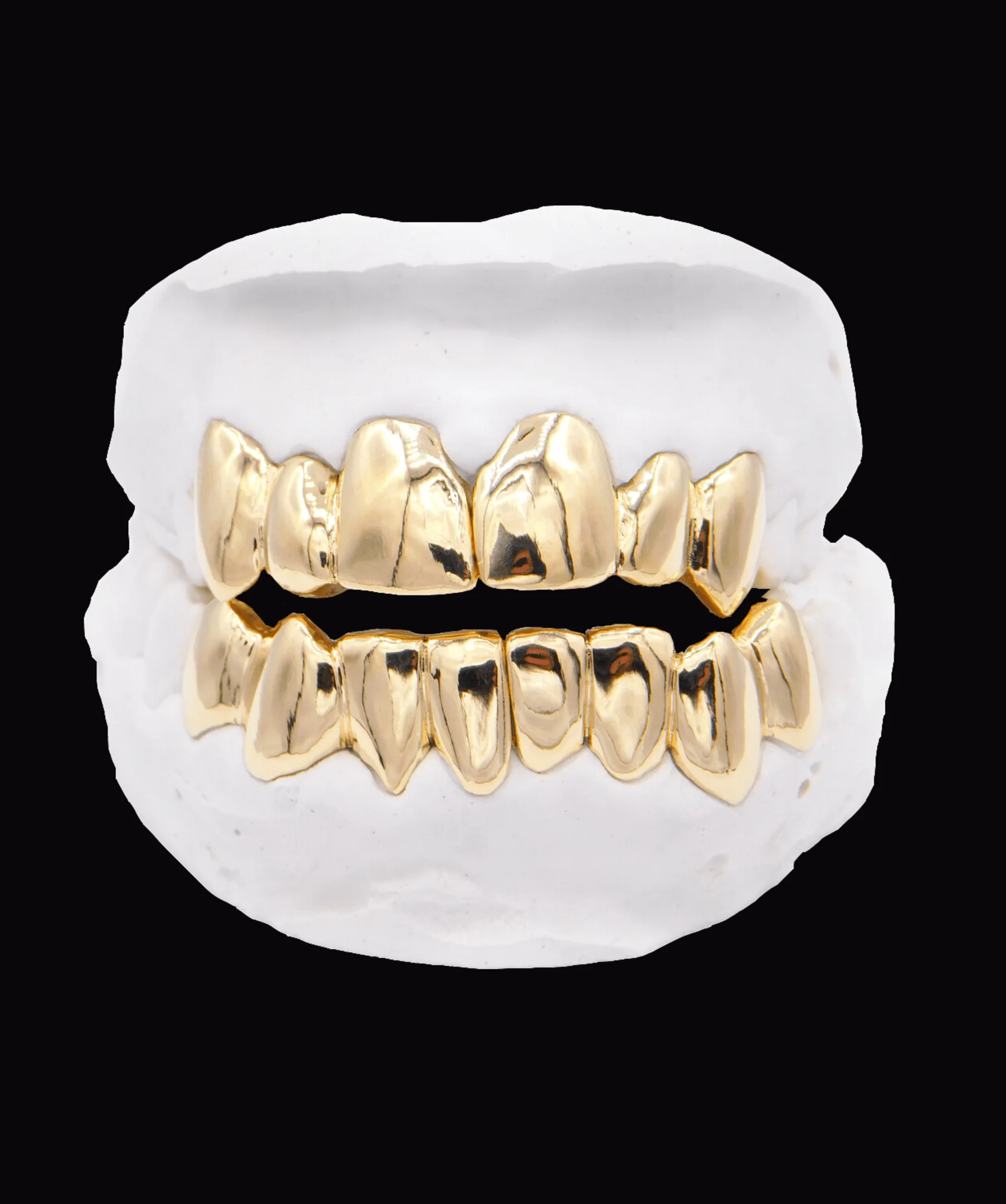 Upper & Lower Gold Grillz